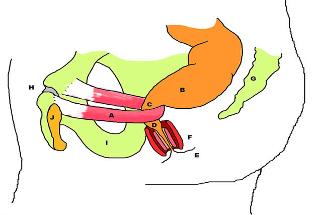 disinergia defecatoria