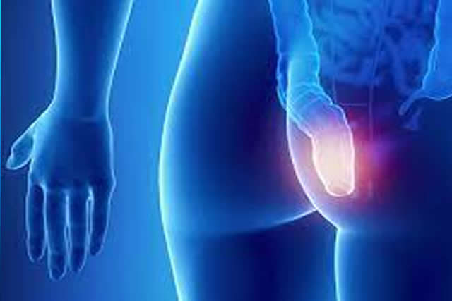 manometria anorrectal